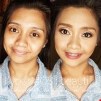 Before and After